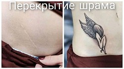 Шрам апендицита тату